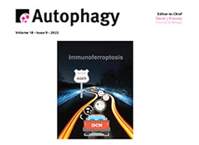 「辉骏客户文章」Autophagy | 发现MIR516A在人类膀胱癌中的独特作用