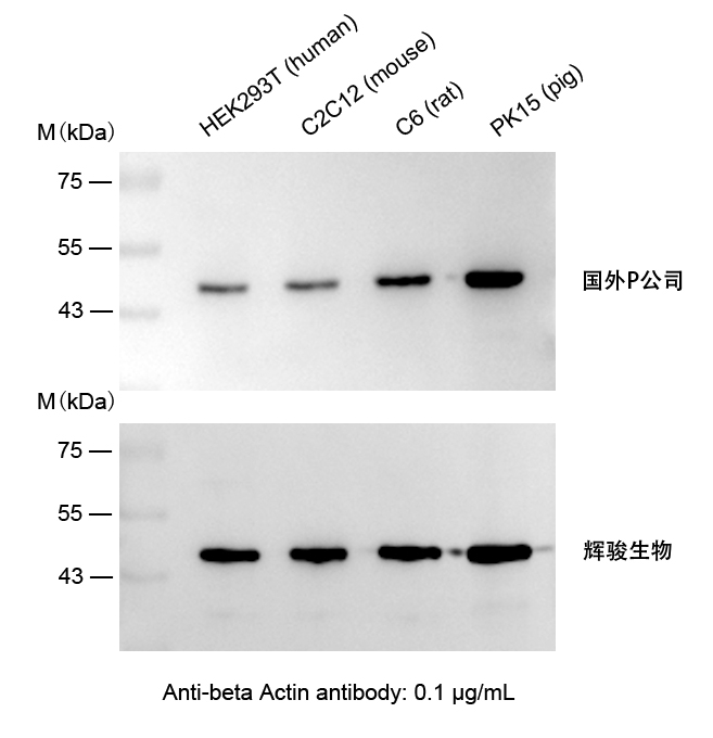β-Actin小鼠单克隆抗体使用案例-抗体操作简单,快速制备Actin抗体-辉骏生物