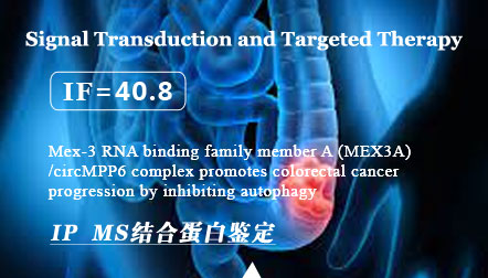 Chen R.X. et al: Mex-3 RNA binding family member A (MEX3A)/circMPP6 complex promotes colorectal cancer progression by inhibiting autophagy