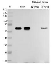RNA pull down WB检测图(阳性) RNA pull down WB检测图(阳性)